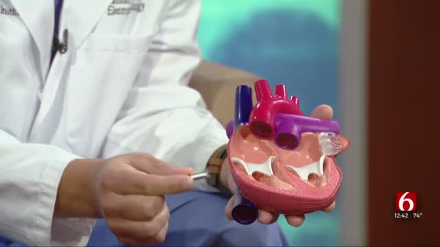 Watch: What To Know About Atrial Fibrillation