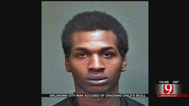 OKC Man Accused Of Cracking Child's Skull