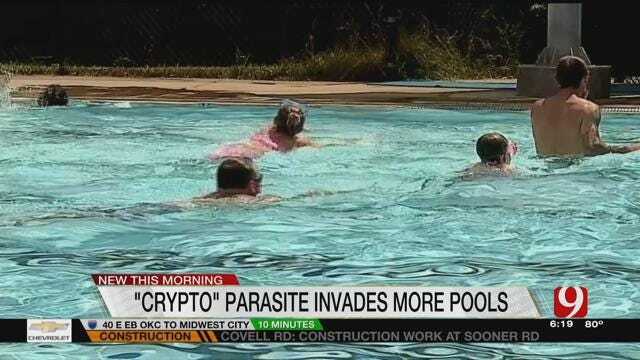 Health Officials Warn Of New Parasite Possibly Hiding In Public Pools