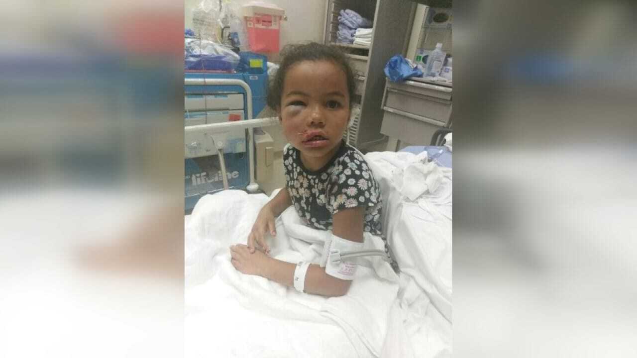 Family Of Child Injured At Muskogee Daycare Frustrated With DHS