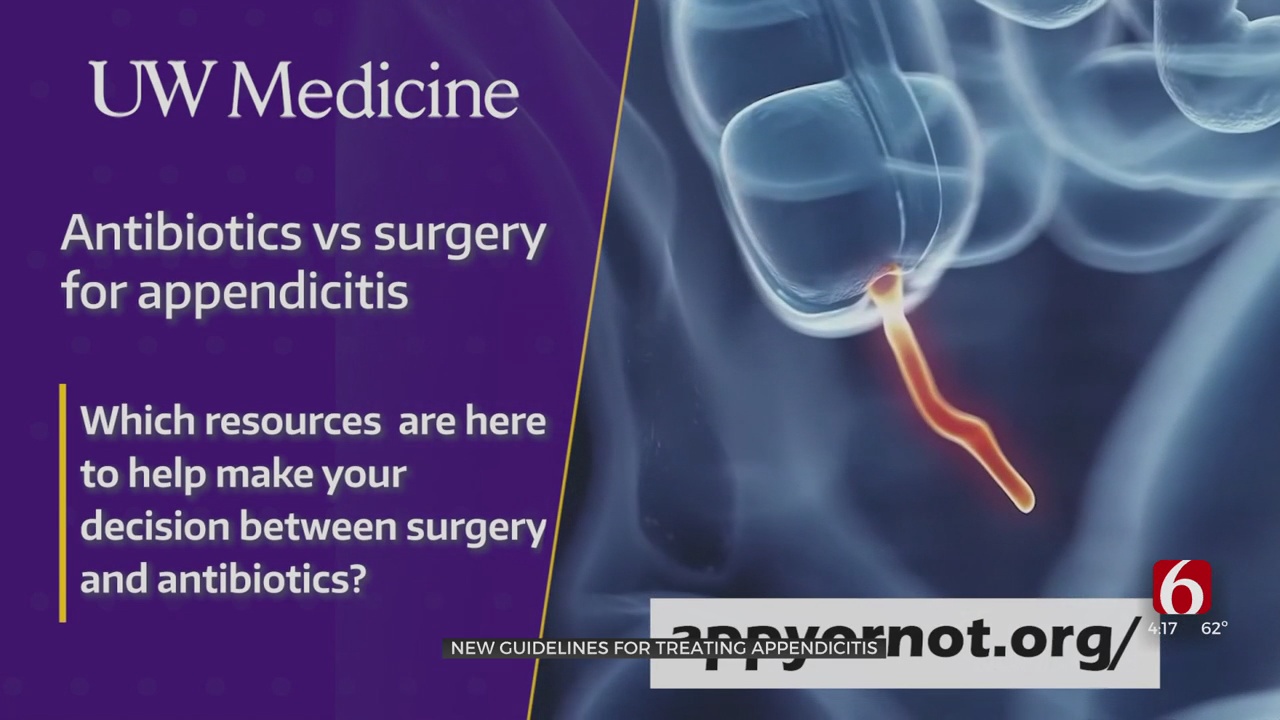 Medical Minute: Alternative Appendectomy Treatment