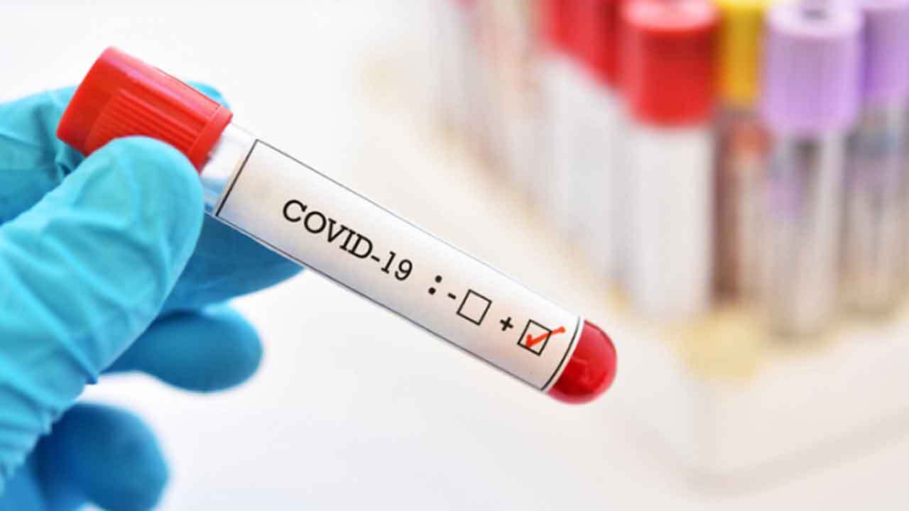 OSDH: 12,187 More COVID-19 Cases Reported Statewide, 36 Virus-Related Deaths Added To Provisional Death Count