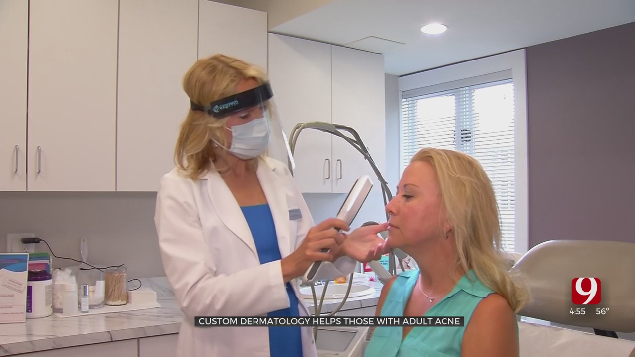 Medical Minute: Custom Dermatology Helps Those With Adult Acne 