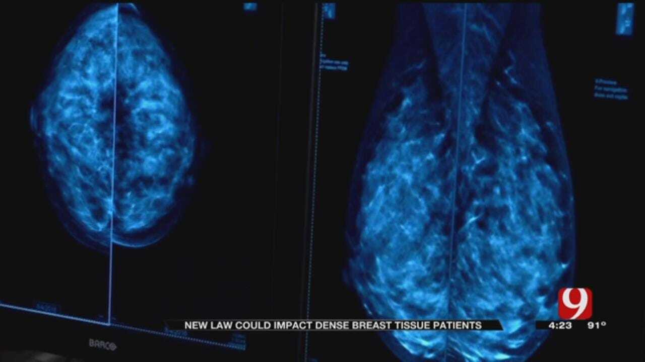 Medical Minute: Breast Tissue Law