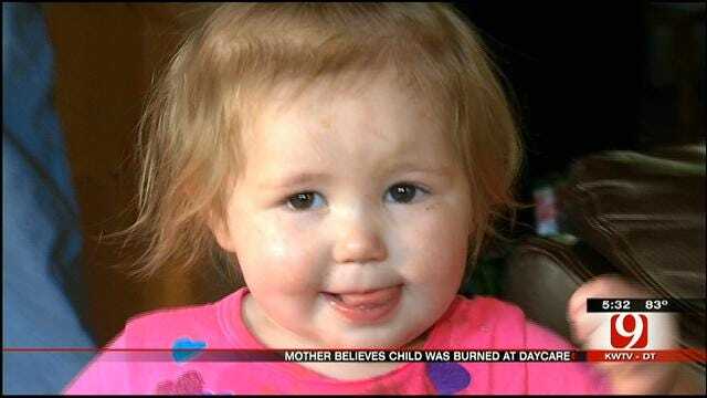 Child Burned, Mother Files Child Neglect Charges Against Shawnee Daycare