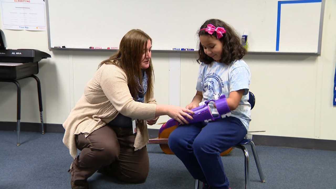 Medical Minute: Teacher Gives 3D Printed Prosthetic Arm To Student