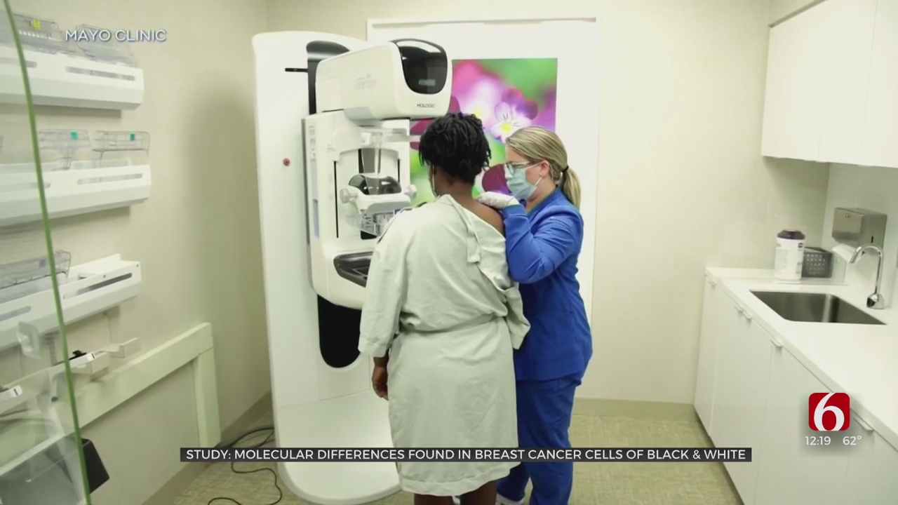 Study: Molecular Differences Found In Breast Cancer Cells Of Black, White Patients