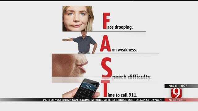 Medical Minute: Spotting A Stroke FAST