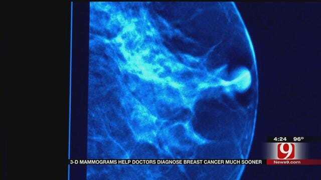 Medical Minute: 3D Mammograms