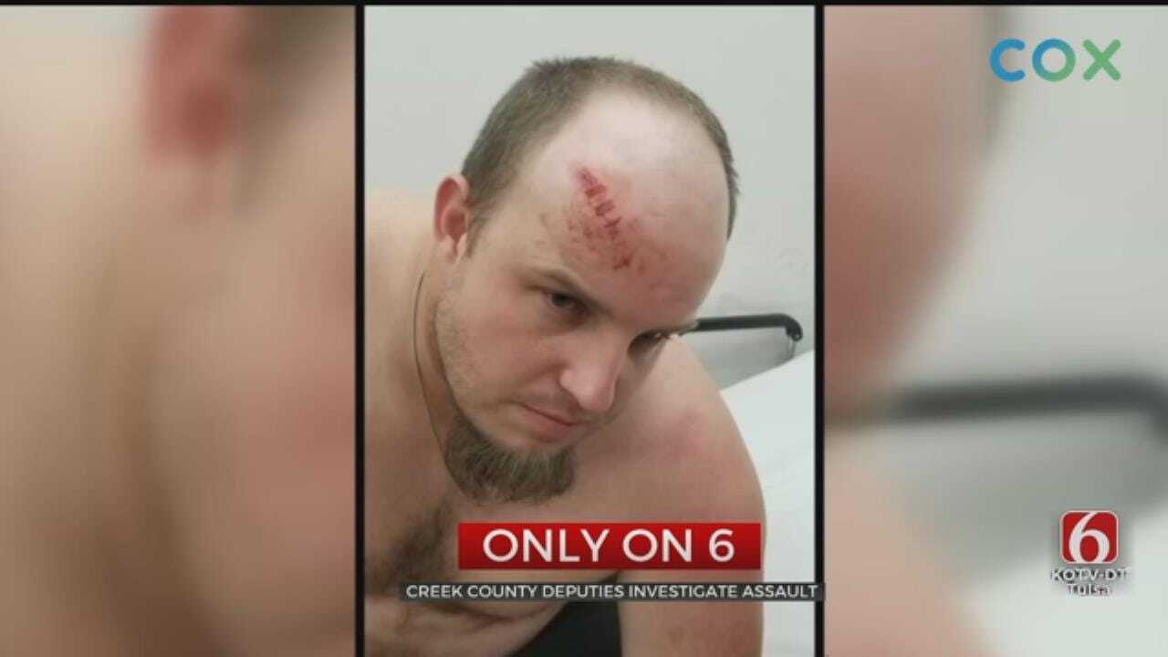 Creek County Man Seriously Hurt After Being Beaten With Crowbars