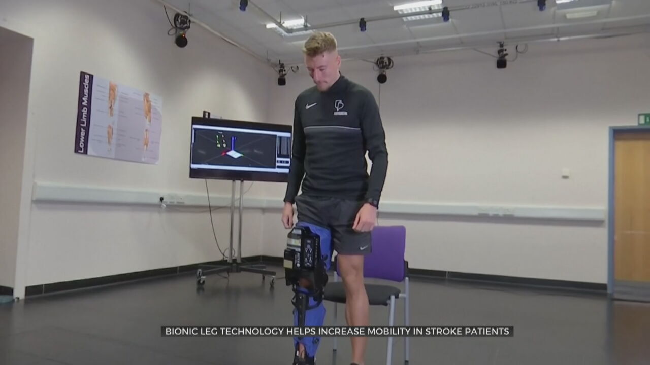 Bionic Leg Technology Helps Increase Mobility In Stroke Patients