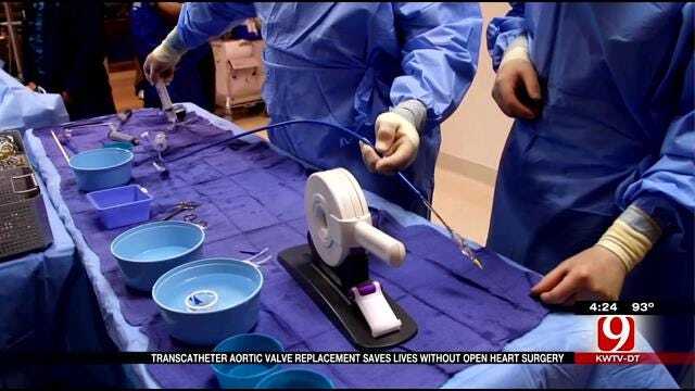 Medical Minute: Heart Surgery