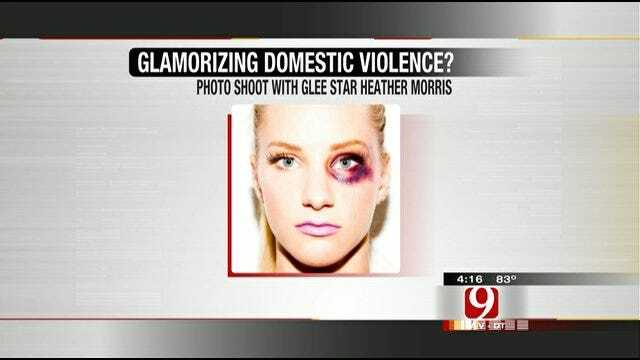 Hot Topics: Is Domestic Abuse A Fashion Statement?