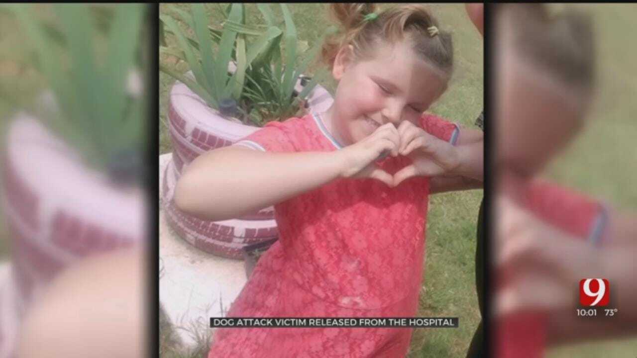 7-Year-Old Girl Released From Hospital After Dog Attack In Cleveland County