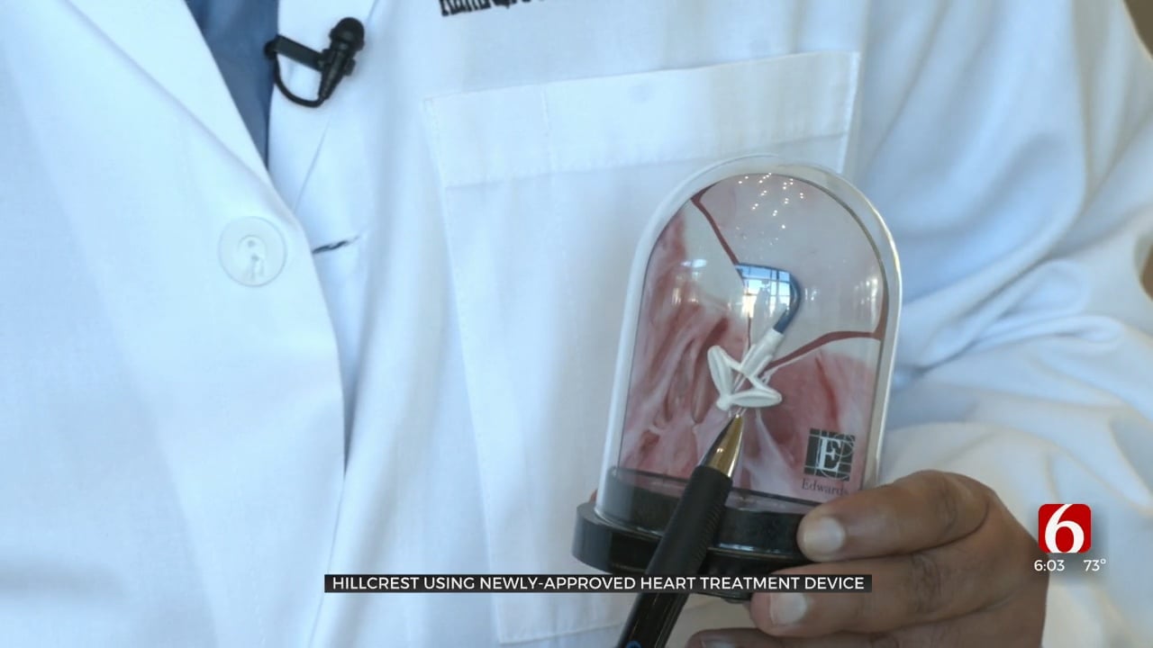 Hillcrest Medical Center Is First To Use Newly Approved Heart Treatment Device