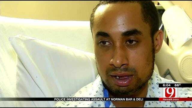 Norman Man Suffers Broken Jaw, Shocked No Witnesses Are Talking