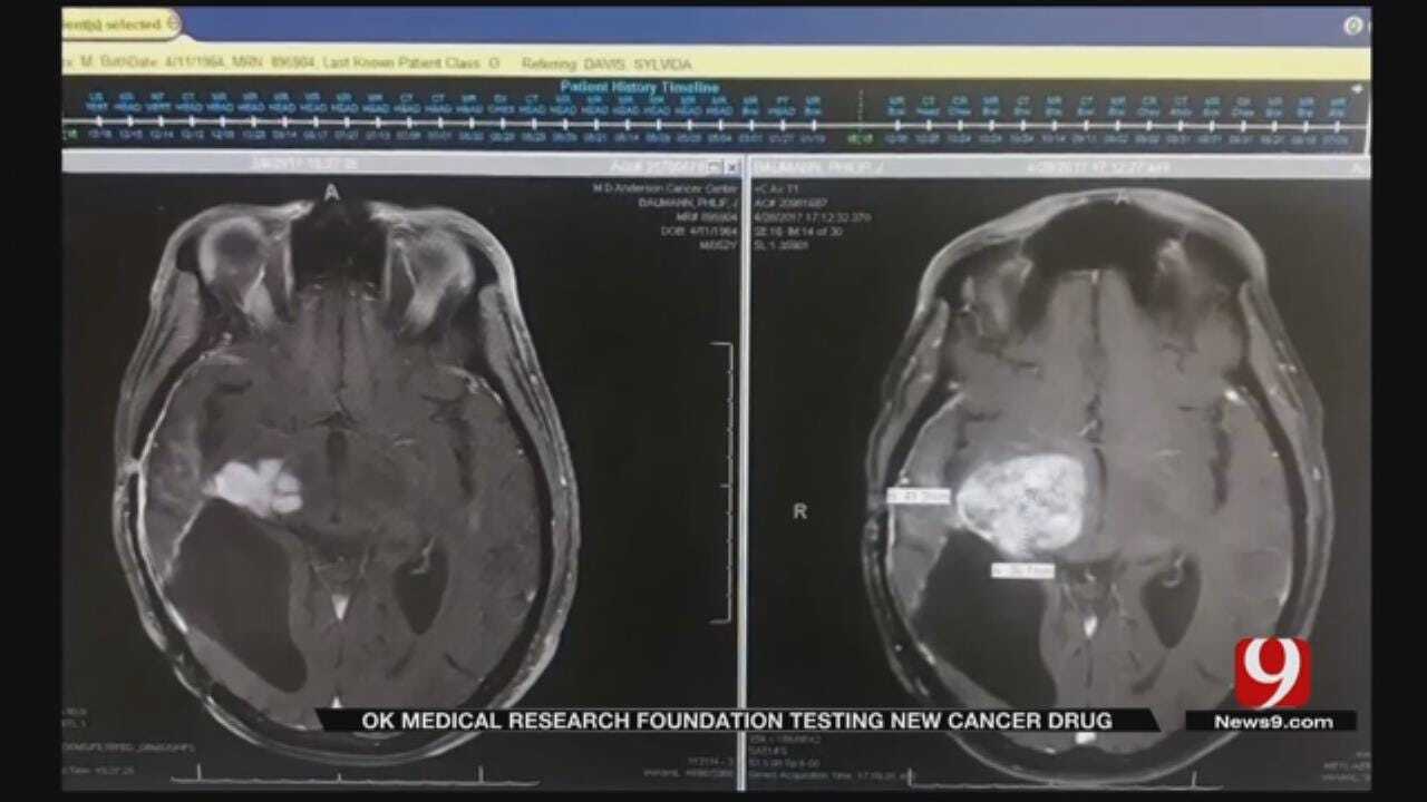Medical Minute: OMRF Testing New Cancer Drug