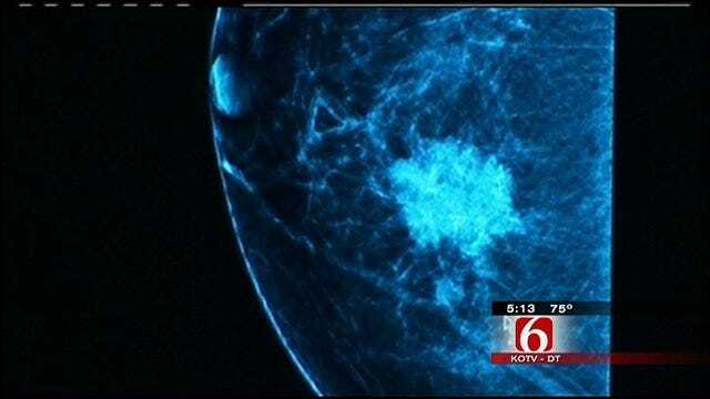 New Technology To Screen For Breast Cancer