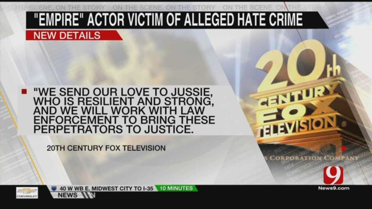 Star On Empire Claims To Be Victim Of Possible Hate Crime