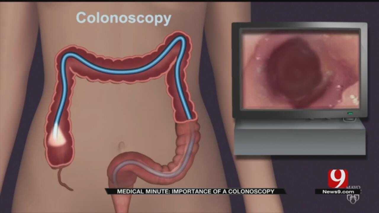 Medical Minute: Colonoscopy Importance