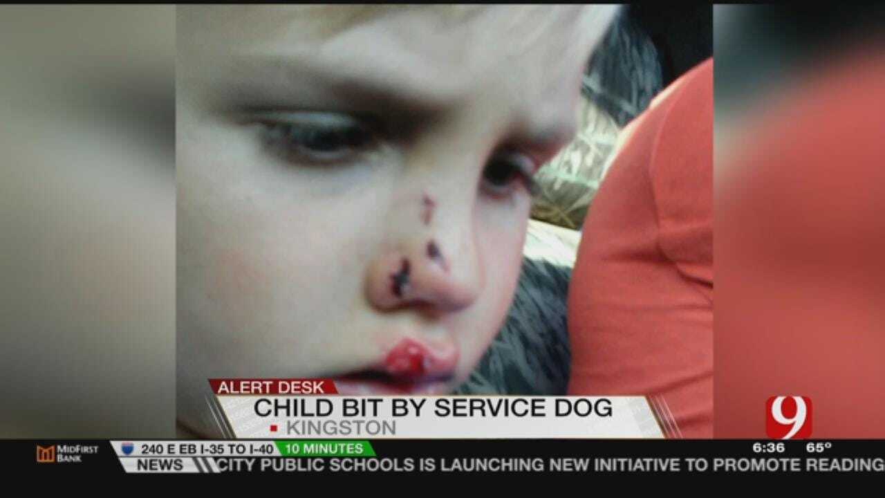 Kingston Boy Recovering After Attack By Service Dog