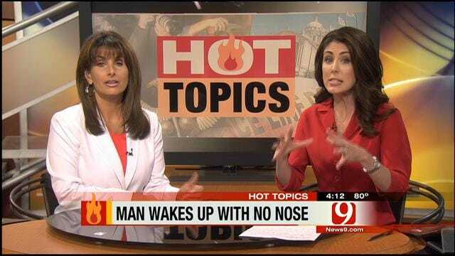 HOT TOPICS: Doctor Removes Tulsa Man's Nose During Surgery