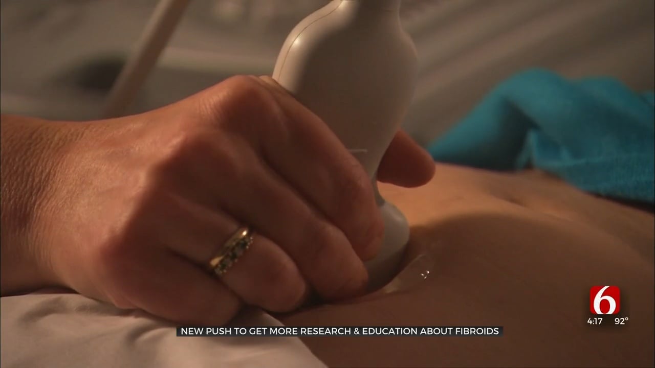 New Push To Get More Research, Education About Fibroids