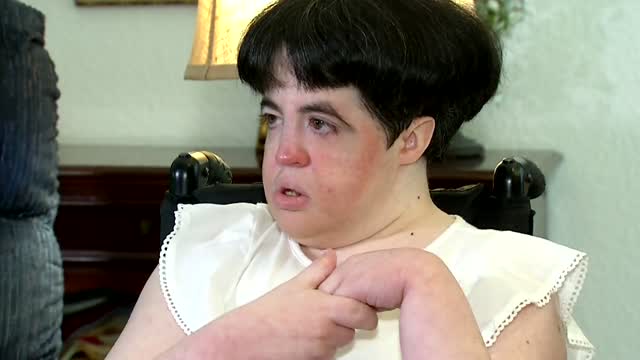 Woman With Special Needs Defies Odds With Each Birthday