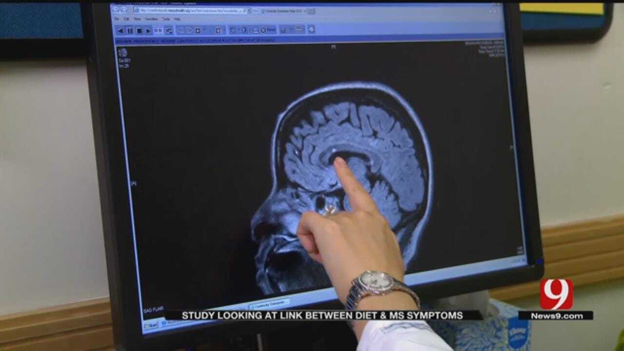 Looking At The Link Between Diet and Multiple Sclerosis