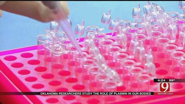 Medical Minute: Role Of Plasmin In Our Bodies