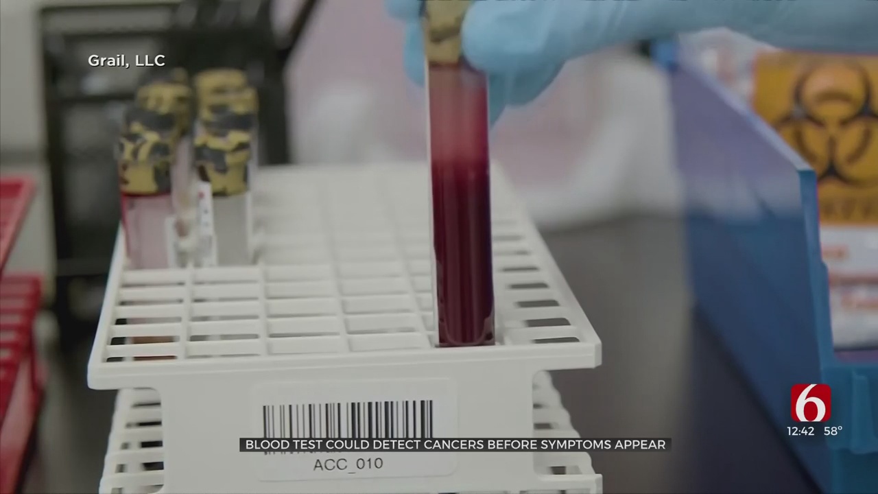 Blood Test Could Detect Cancers Before Symptoms Appear