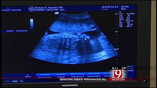 Oklahoma Personhood Bill Says Life Begins At Conception