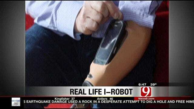 Man Has Smartphone Dock In Prosthetic Arm