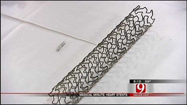 Medical Minute: Improved Heart Stents