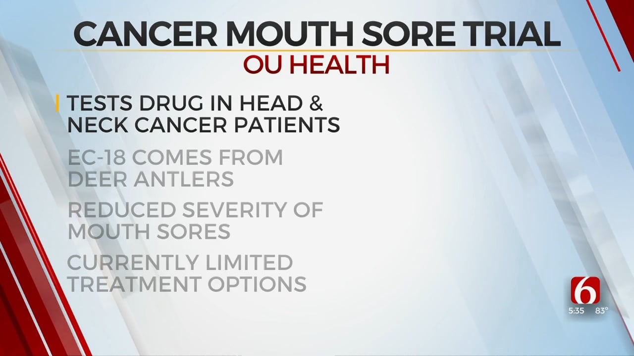 OU Health Tests Deer Antler Compound As Cancer Mouth Sore Treatment