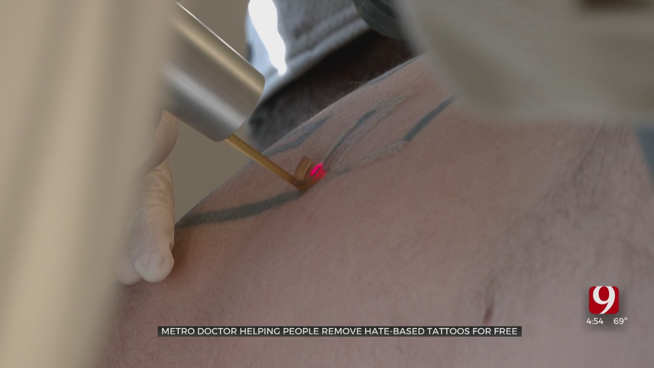 Oklahoma City Doctor Helping People Remove Hateful Tattoos For Free 