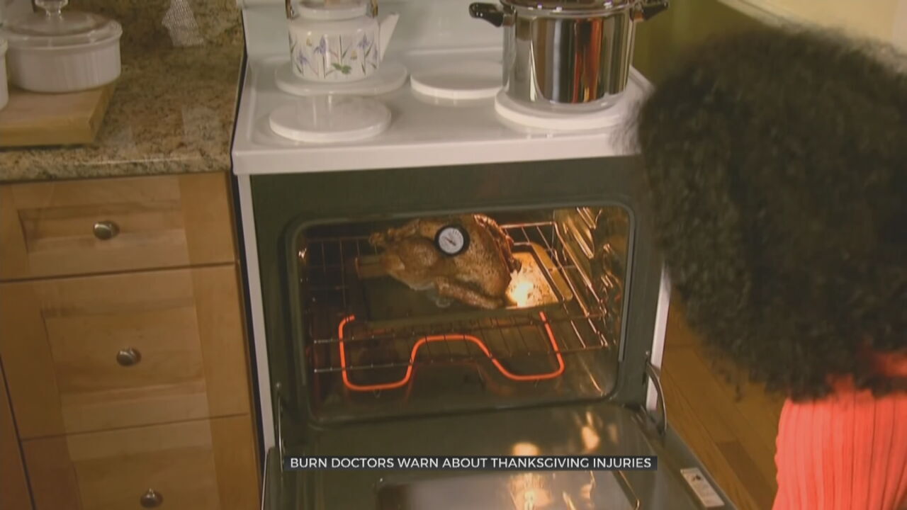 Health Experts Remind People Of Cooking Safety This Thanksgiving
