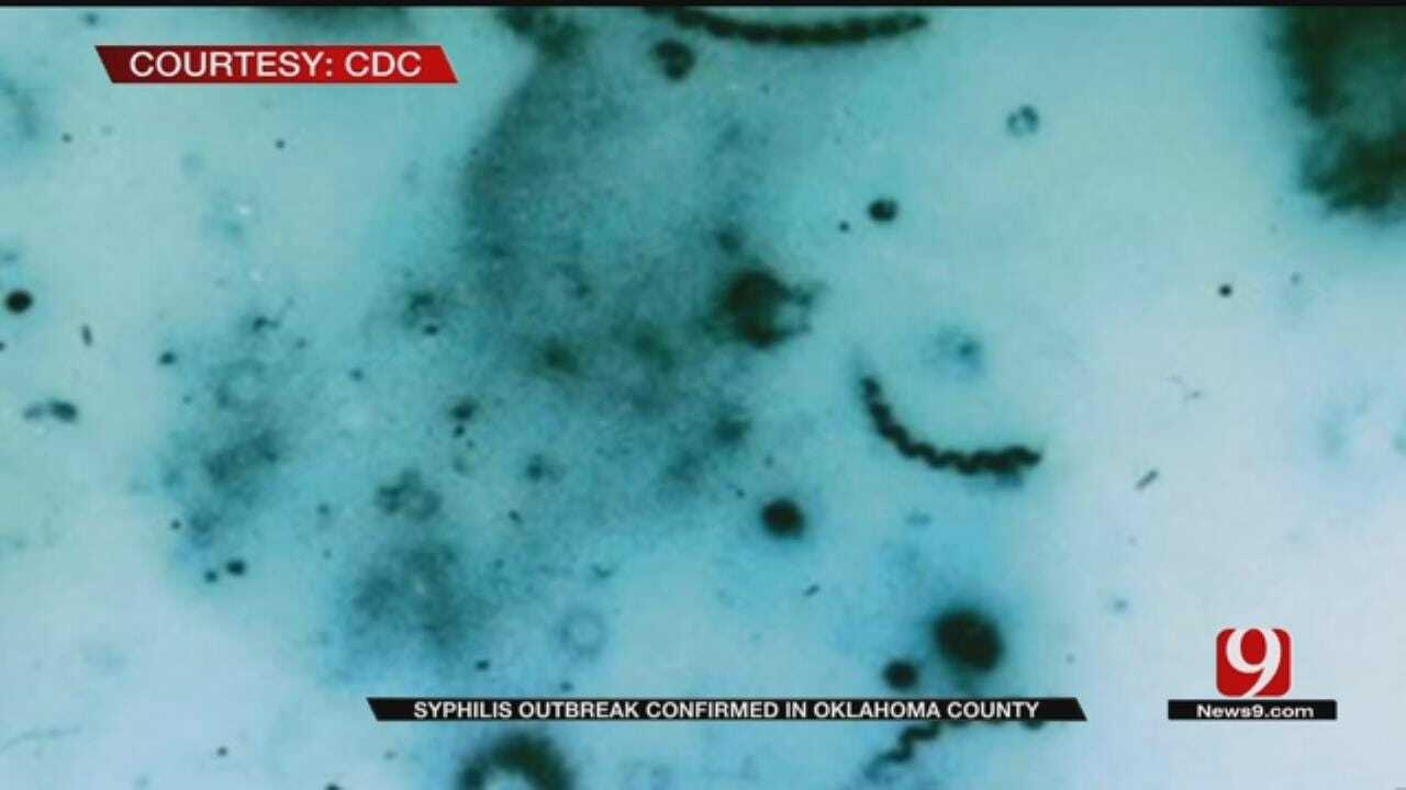Health Department Reports Syphilis Outbreak In OK Co.