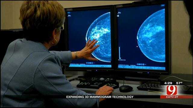 Medical Minute: Expanding 3D Mammogram Technology