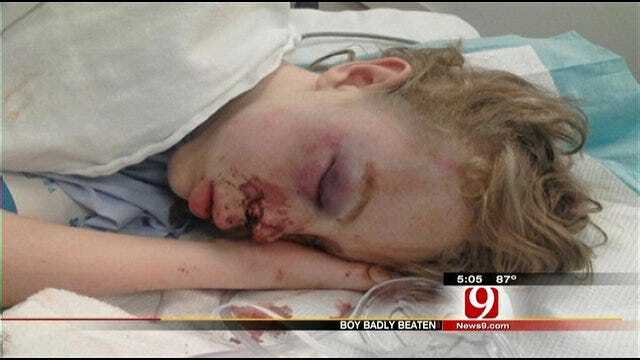 Enid Teen Injured In Fight With Classmate Released From Hospital