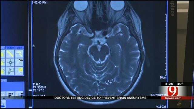 Medical Minute: Doctors Testing Device To Prevent Brain Aneurysms