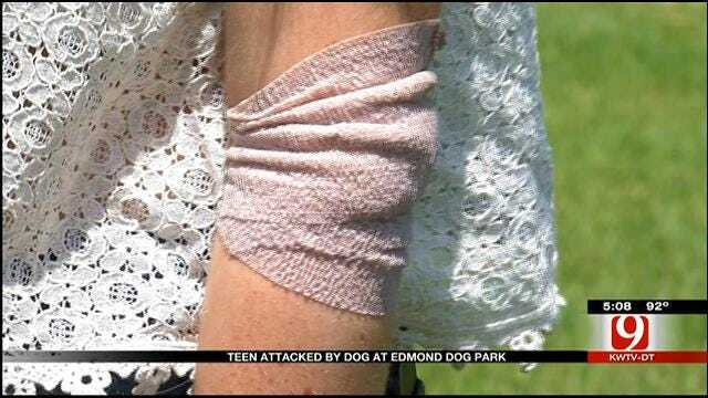 Edmond Family Hopes City Will Revise Rules After Dog Park Attack