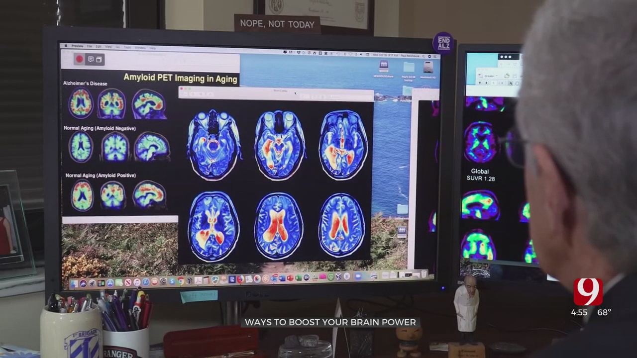 Medical Minute: How To Boost Your Brain Power