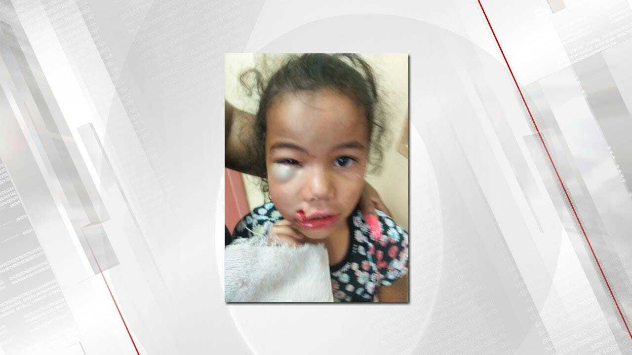 Family Waiting For Answers After Child Injured At Muskogee Daycare