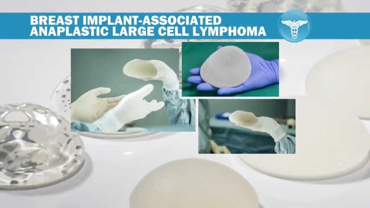 FDA Proposes 'Black-Box Warning' For Breast Implants – Its Strongest Form Of Caution