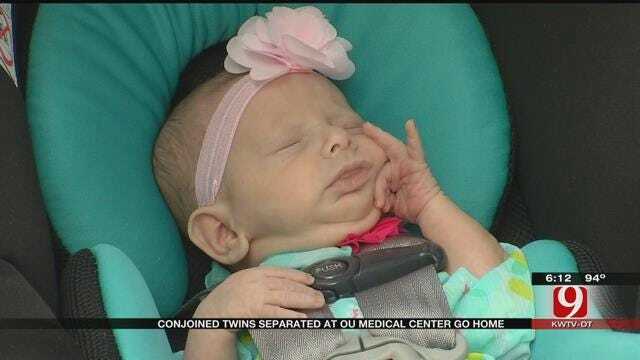 Conjoined Twins Separated At OU Medical Center Go Home