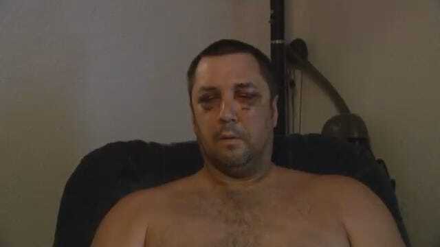 Man Says He Was Beaten, Left For Dead By OKCPD Officers On Illinois River