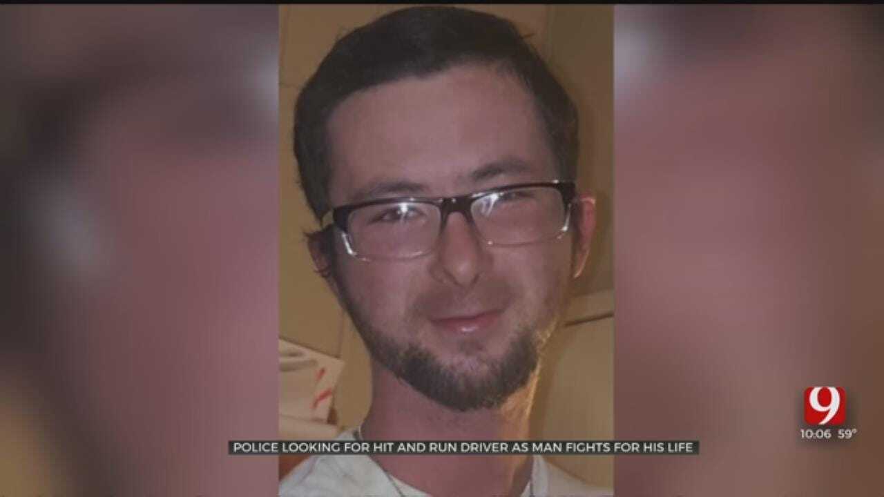 Police Searching For Hit-And-Run Driver As Pott. Co. Man Fights For His Life