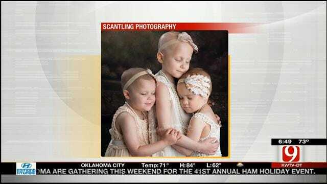 OK Young Cancer Patients Featured In Viral Photo Now In Remission