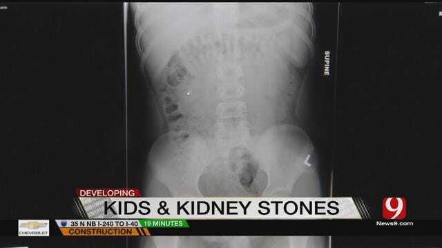 Doctors Seeing More Children With Kidney Stones